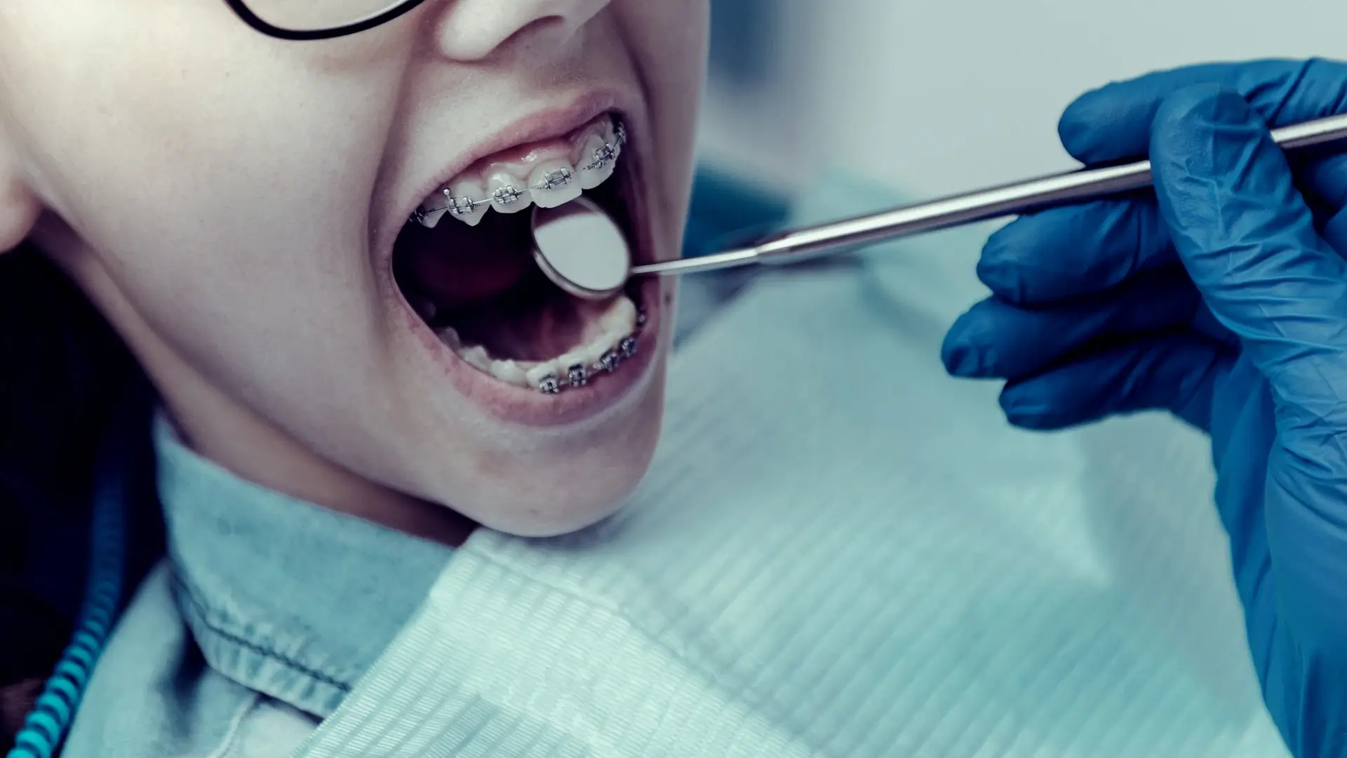 Braces for Kids and Teens in Miami, FL | Call (786) 841-8482