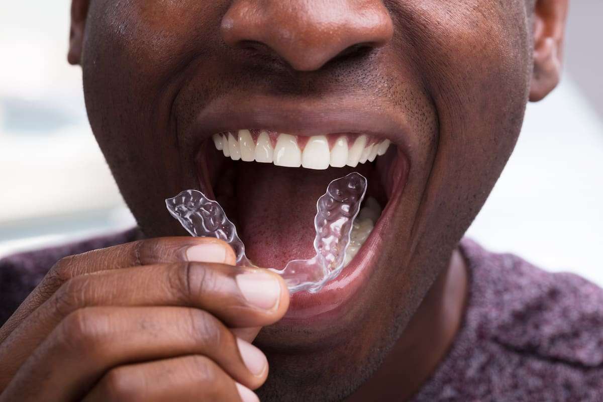 What To Do if Invisalign® Cracks | Cosmetic Dentist Miami | Dr. Patty
